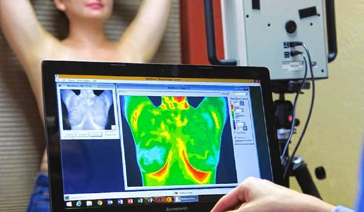 termografia doctor lucena mamaria mamografia cancer de mama prevencion colombia