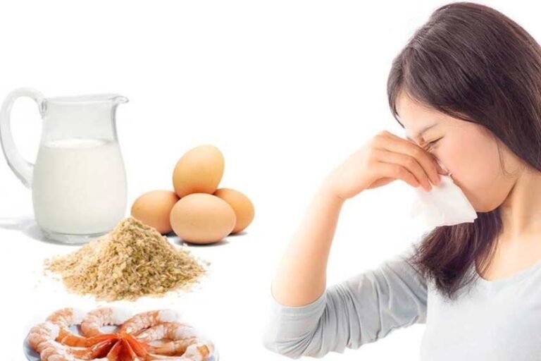 alergias alimenticias tipos comidas salud examen