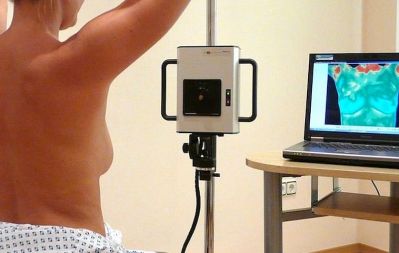 termografia mamaria cancer mama seno prevencion bultos