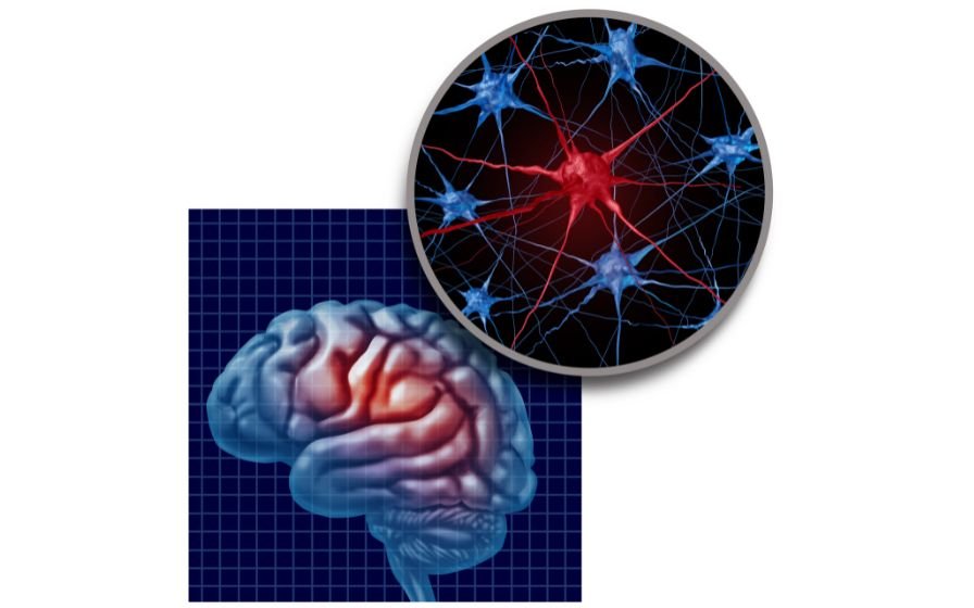 Que es el Parkinson Entendiendo la enfermedad desde un enfoque integrativo (2)